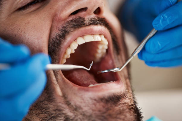 Best Emergency Dental Care for Trauma or Injury in Fort Pierce South, FL