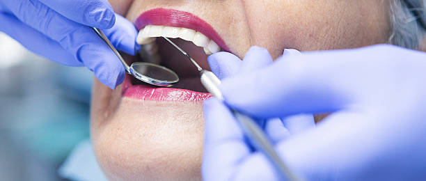 Best Emergency Broken Tooth Repair in Fort Pierce South, FL
